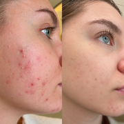 Velour Vitamin C Booster Serum