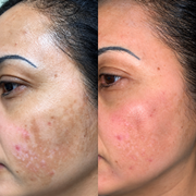 Velour Vitamin C Booster Serum