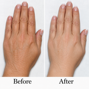 Hair Removal Cream