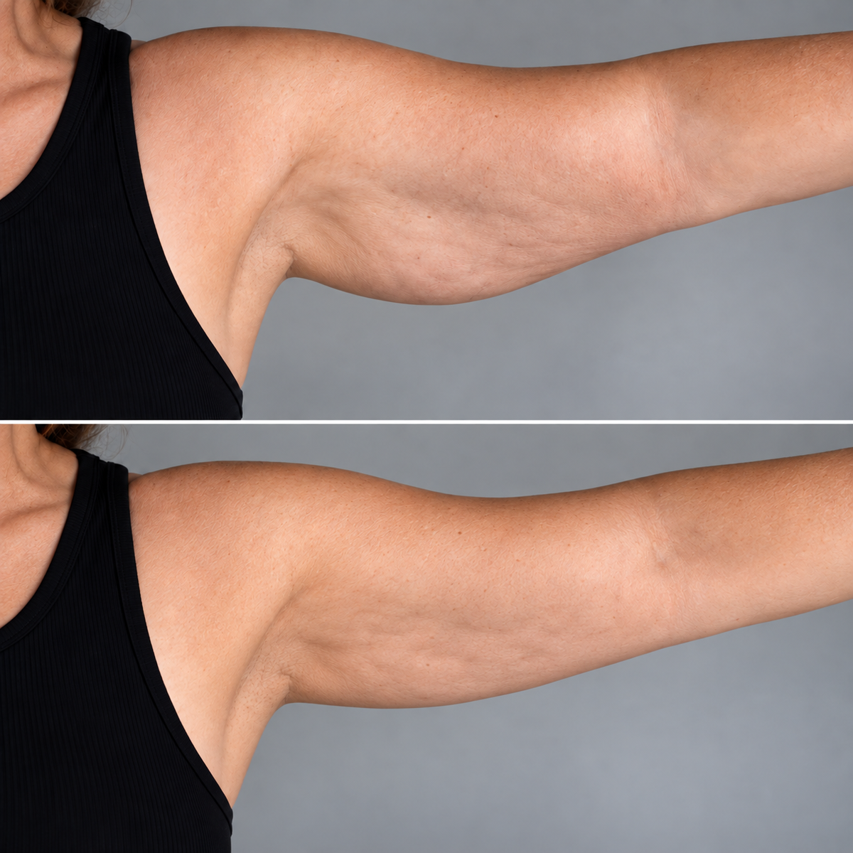 Deep tissue Sculptor
