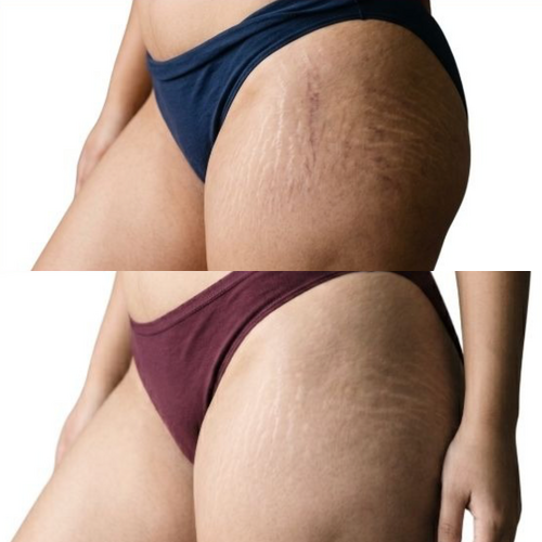 Velour Blur Cryo Thermo Firming Gold Gel