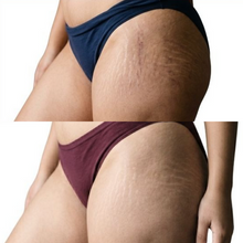 Cryo Thermo Cellulite Gel